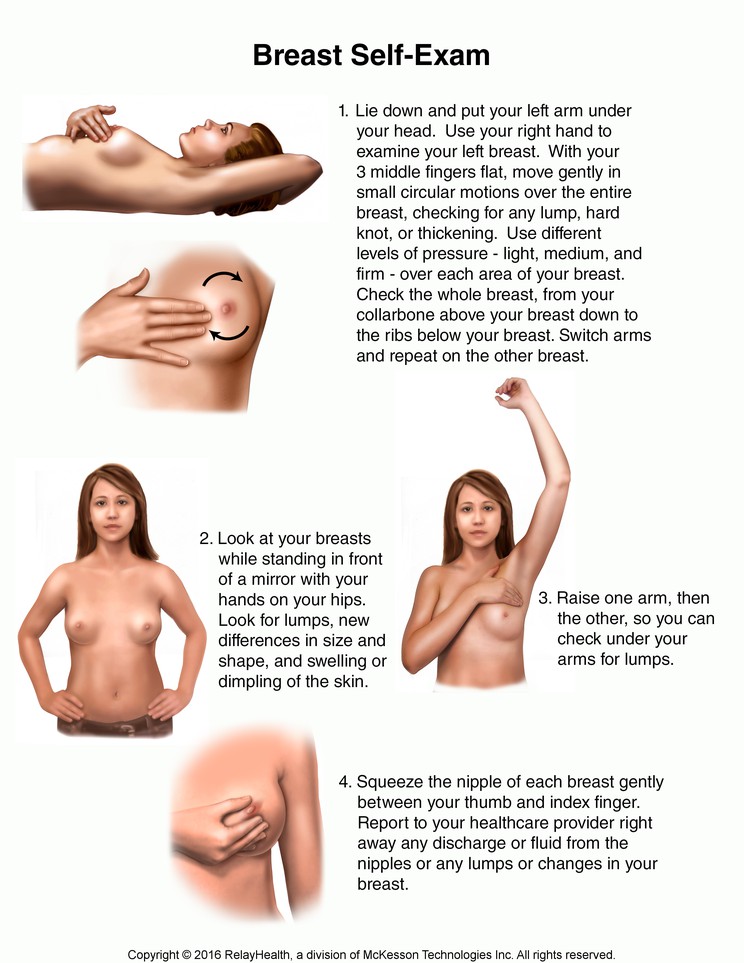 Breast Self-Exam: Illustration