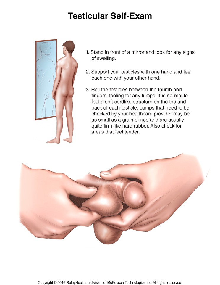 Testicular Self-Exam: Illustration