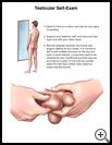 Thumbnail image of: Testicular Self-Exam: Illustration