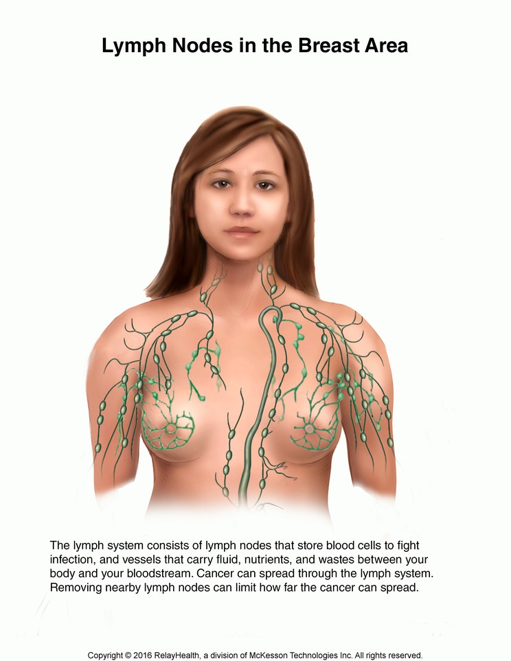 Breast Lymph Nodes: Illustration