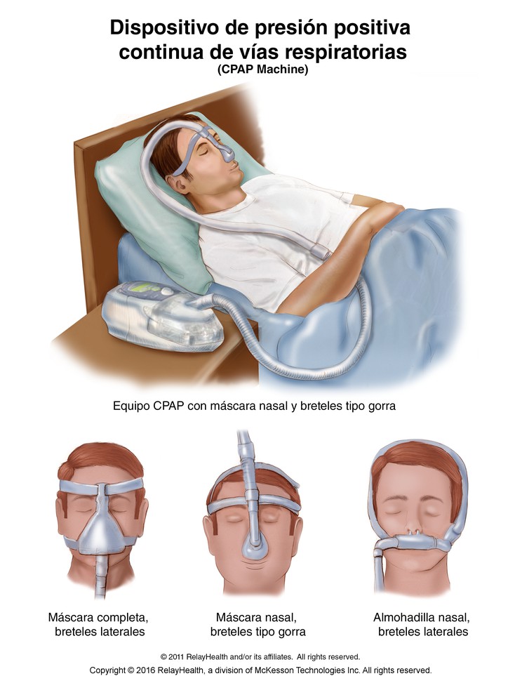 CPAP Machine: Illustration