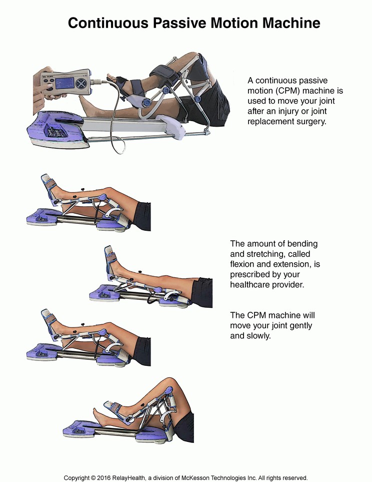 Continuous Passive Motion Machine: Illustration