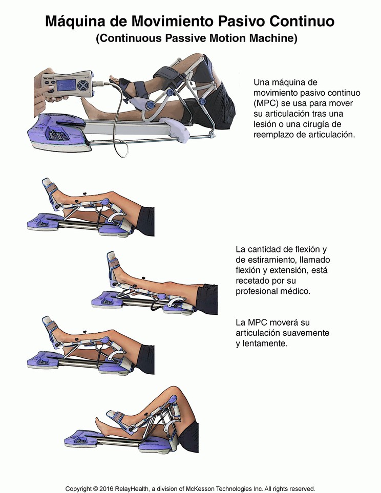 Continuous Passive Motion Machine: Illustration