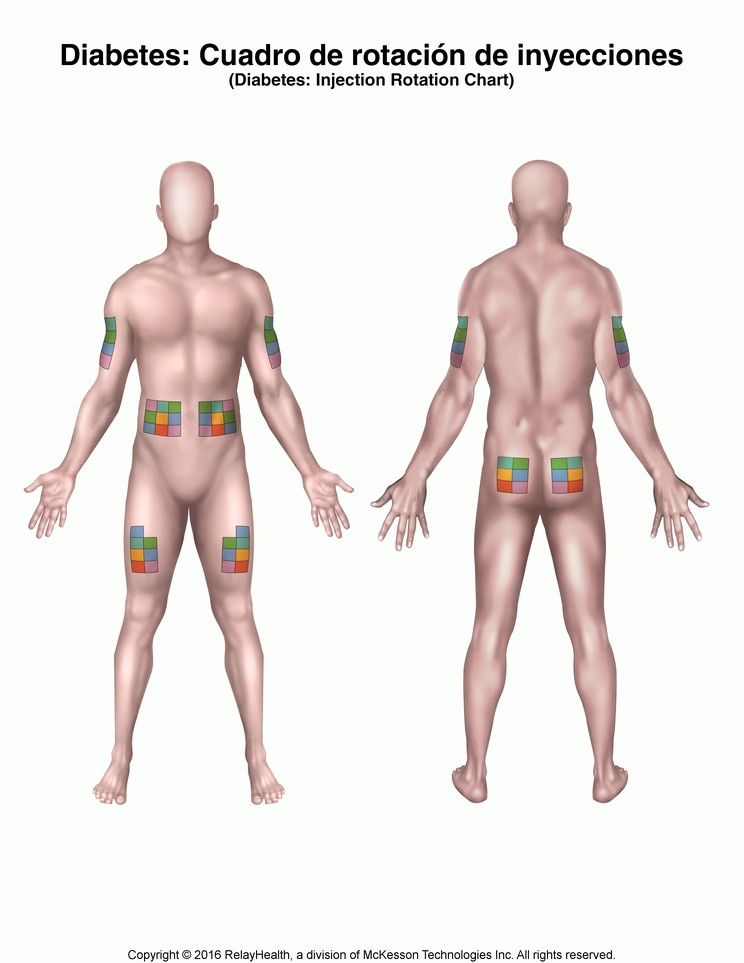 Diabetes, Injection Rotation Chart: Illustration