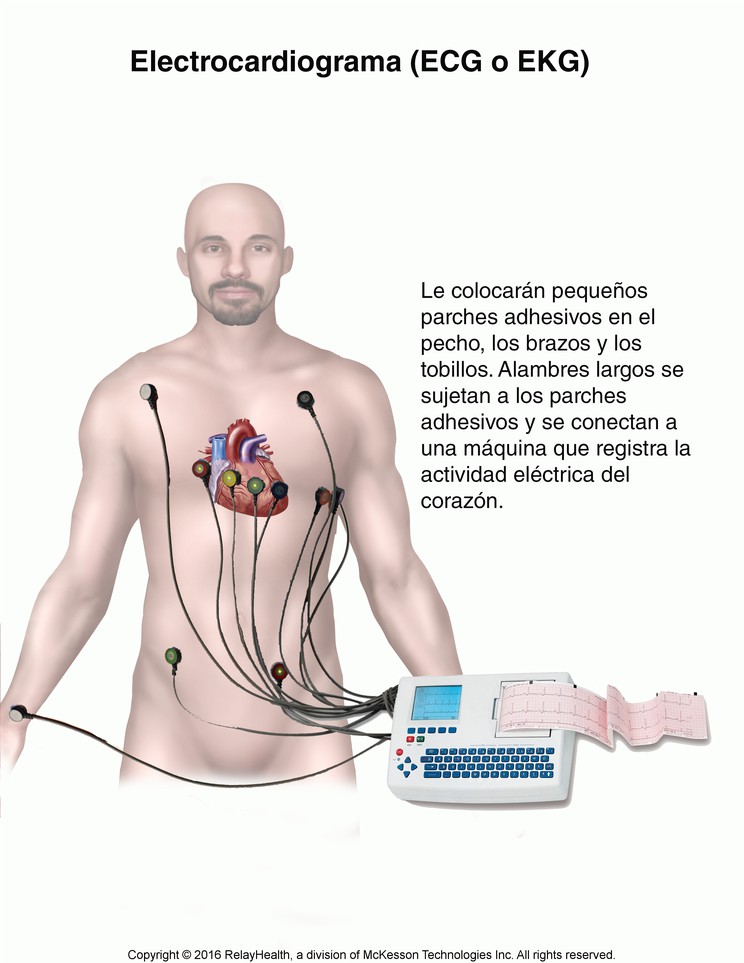 Electrocardiogram (ECG or EKG): Illustration