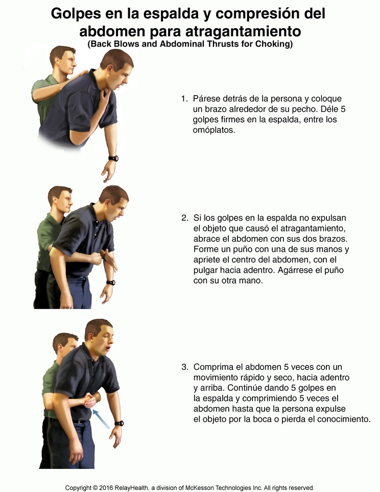 Back Blows and Abdominal Thrusts for Choking: Illustration