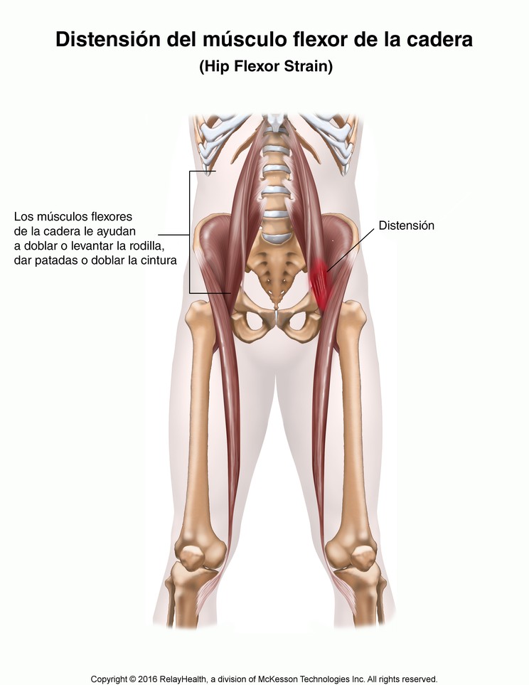 Hip Flexor Strain: Illustration