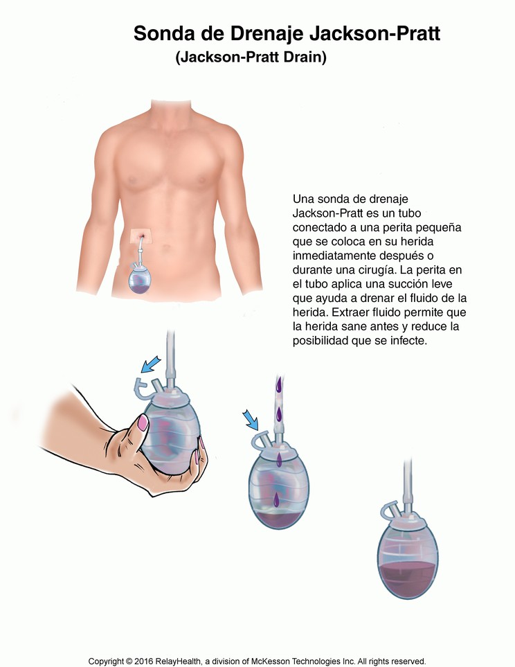 Jackson-Pratt Drain: Illustration