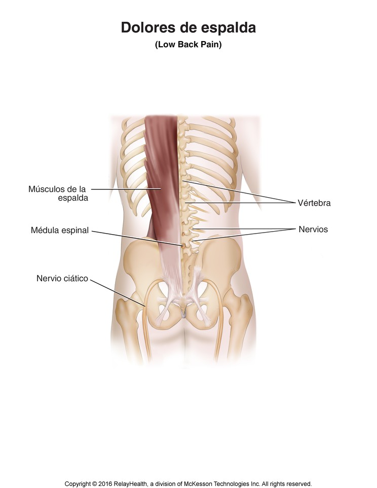 Low Back Pain: Illustration
