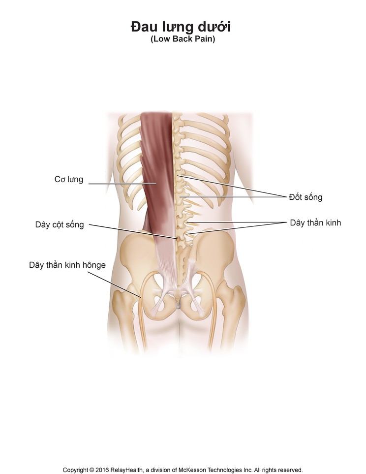 Low Back Pain: Illustration