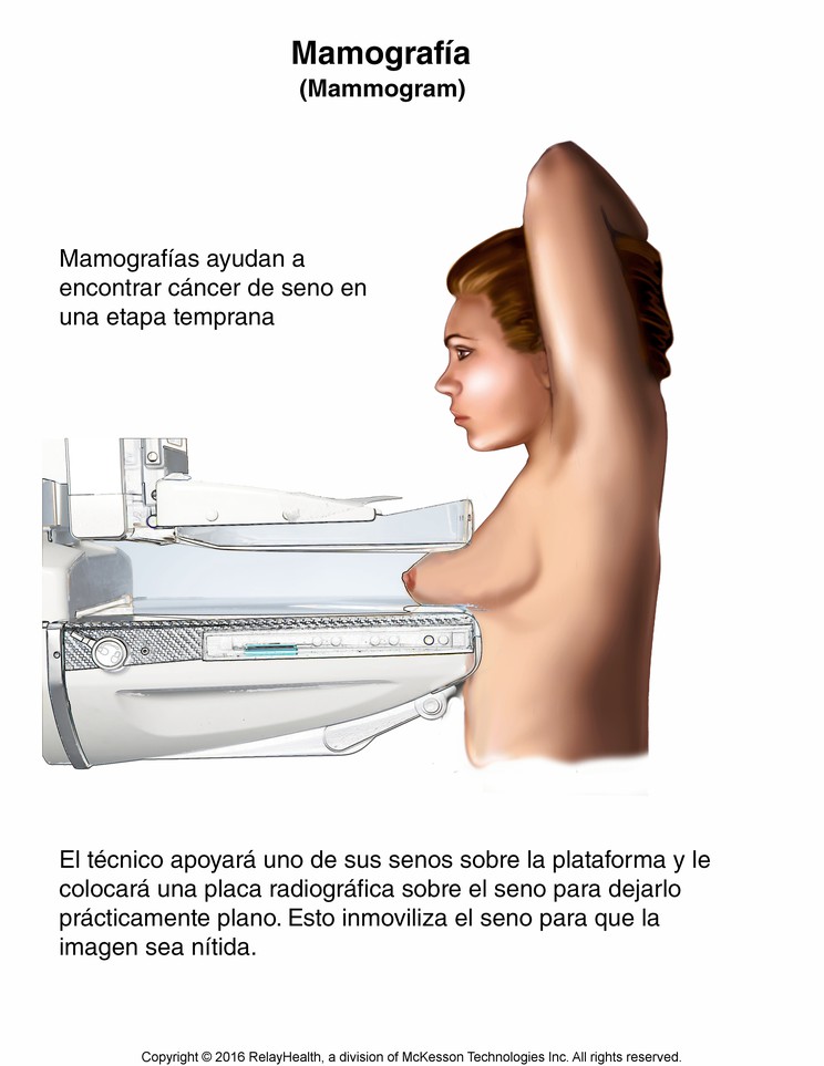 Mammogram: Illustration
