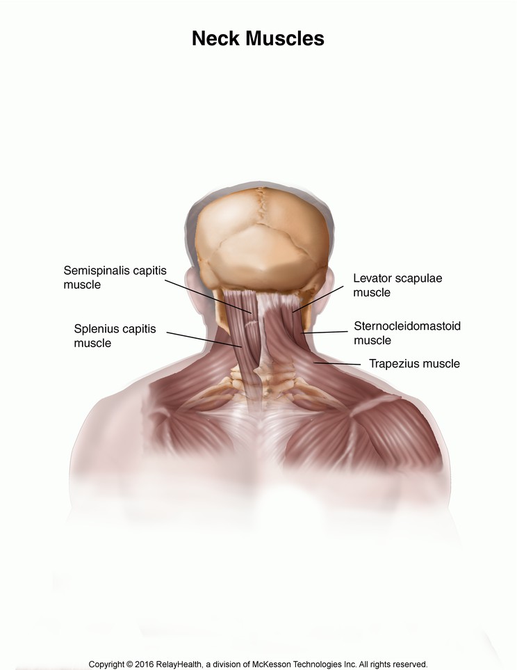 Neck Strain: Illustration