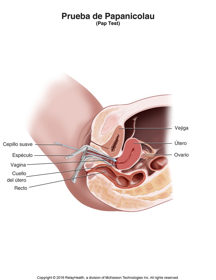 Pap Test: Illustration