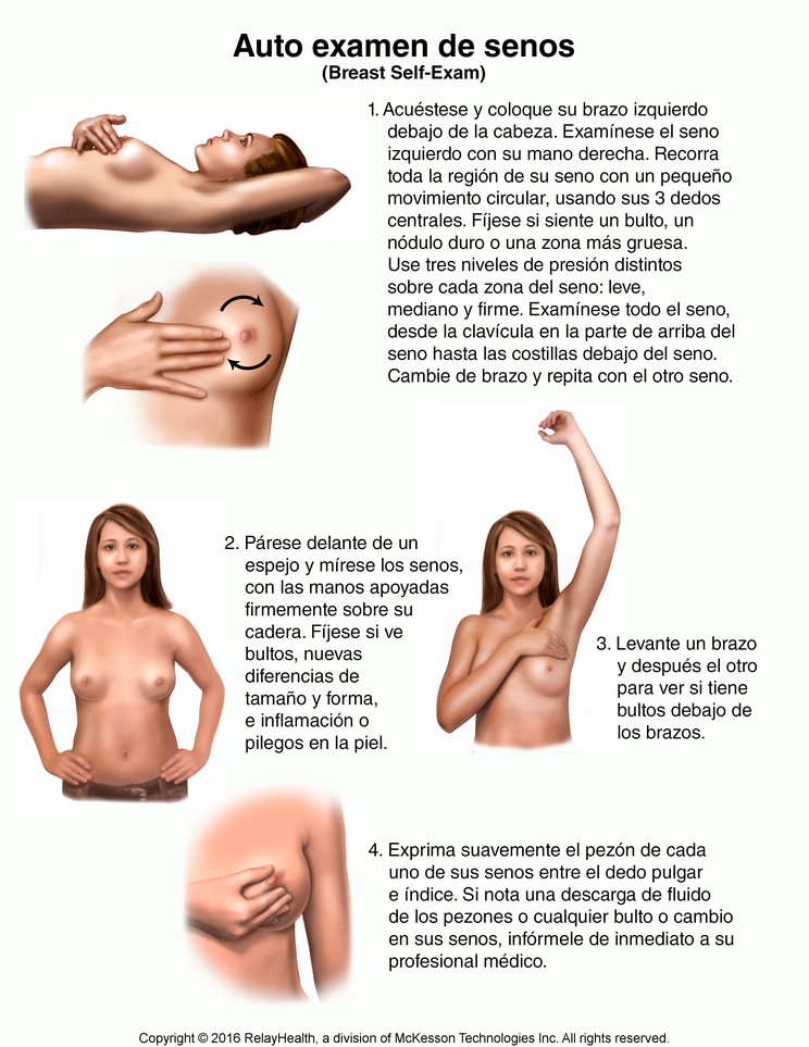Breast Self-Exam: Illustration