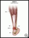 Thumbnail image of: Achilles Tendon Injury: Illustration