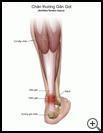 Thumbnail image of: Achilles Tendon Injury: Illustration