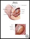 Thumbnail image of: Amniocentesis: Illustration