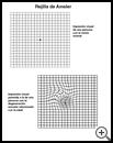 Thumbnail image of: Amsler Grid: Illustration