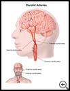 Thumbnail image of: Carotid Arteries: Illustration