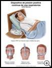 Thumbnail image of: CPAP Machine: Illustration
