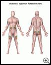 Thumbnail image of: Diabetes, Injection Rotation Chart: Illustration
