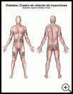 Thumbnail image of: Diabetes, Injection Rotation Chart: Illustration