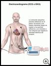 Thumbnail image of: Electrocardiogram (ECG or EKG): Illustration
