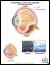 Thumbnail image of: Eye Flashes and Floaters: Illustration