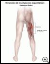 Thumbnail image of: Hamstring Strain: Illustration