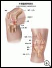 Thumbnail image of: Lateral Collateral Ligament Injury: Illustration