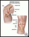 Thumbnail image of: Lateral Collateral Ligament Injury: Illustration