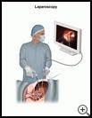 Thumbnail image of: Laparoscopy: Illustration