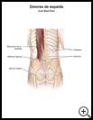 Thumbnail image of: Low Back Pain: Illustration