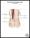 Thumbnail image of: Low Back Pain: Illustration