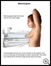 Thumbnail image of: Mammogram: Illustration