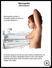 Thumbnail image of: Mammogram: Illustration