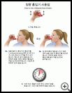 Thumbnail image of: Metered-Dose Inhaler, How to Use: Illustration