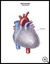 Thumbnail image of: Pericardium: Illustration