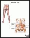 Thumbnail image of: Sacroiliac Pain: Illustration
