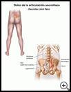 Thumbnail image of: Sacroiliac Joint Pain: Illustration