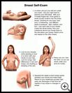 Thumbnail image of: Breast Self-Exam: Illustration