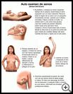 Thumbnail image of: Breast Self-Exam: Illustration