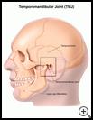 Thumbnail image of: Temporomandibular Joint: Illustration
