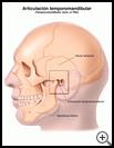 Thumbnail image of: Temporomandibular Joint (TMJ): Illustration