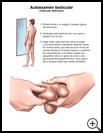 Thumbnail image of: Testicular Self-Exam: Illustration
