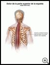 Thumbnail image of: Upper Back Pain: Illustration