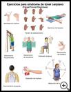 Thumbnail image of: Carpal Tunnel Syndrome Exercises: Illustration
