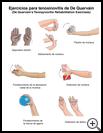 Thumbnail image of: De Quervain's Tenosynovitis Exercises: Illustration