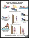 Thumbnail image of: Groin Strain Exercises: Illustration
