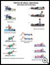 Thumbnail image of: Herniated Disk Exercises: Illustration